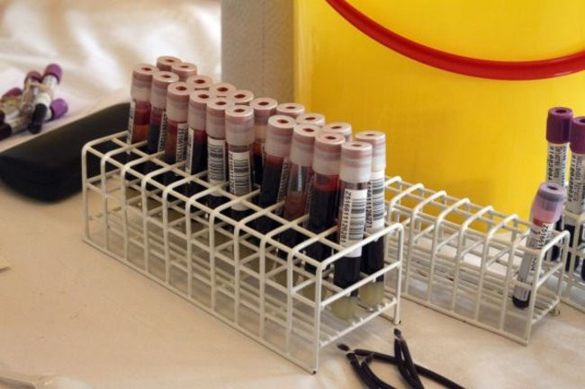 Tłumy oddawały krew (zdjęcia)