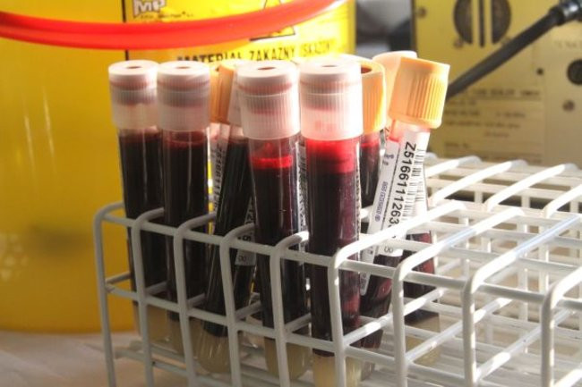 W Koniorze krew się leje (zdjęcia)