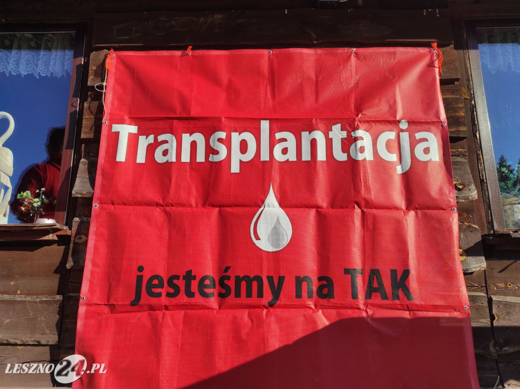 Transplancja. Jesteśmy na TAK