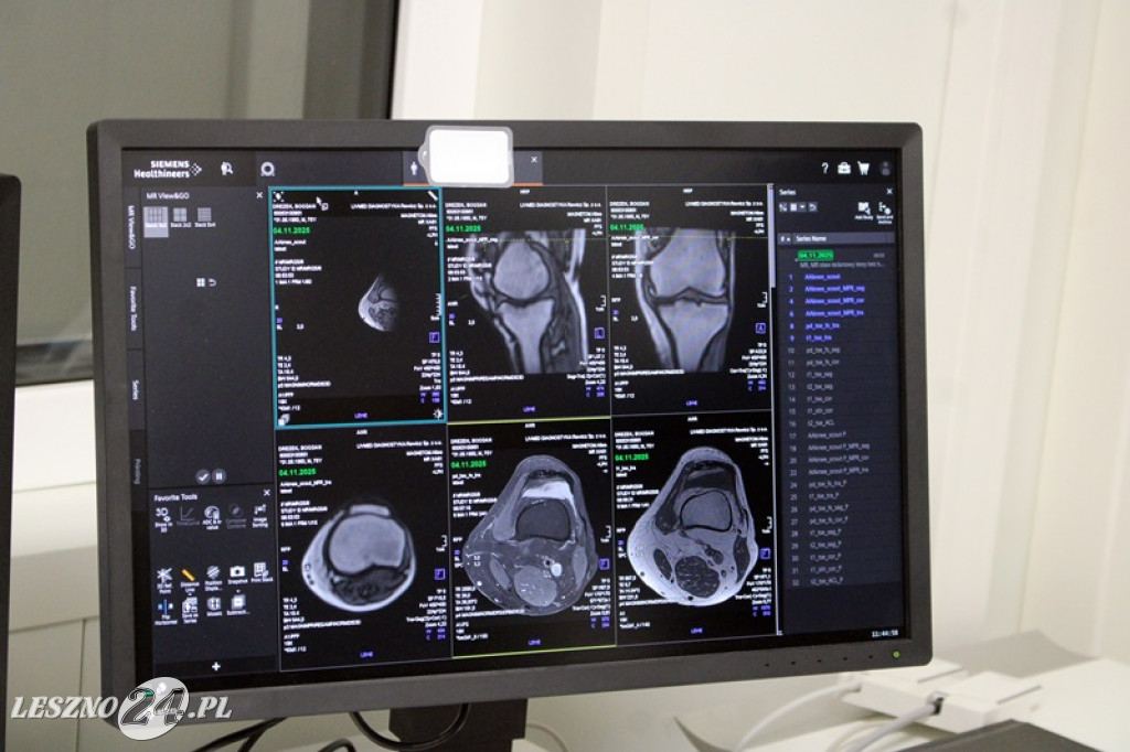 Rezonans magnetyczny w Rawiczu otwarty