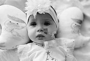 Nie żyje 1,5-roczna Zojka Frąckowiak z Leszna. Miała guza mózgu-81934