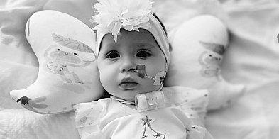 Nie żyje Zojka z Leszna. Miała tylko 1,5 roku-81934