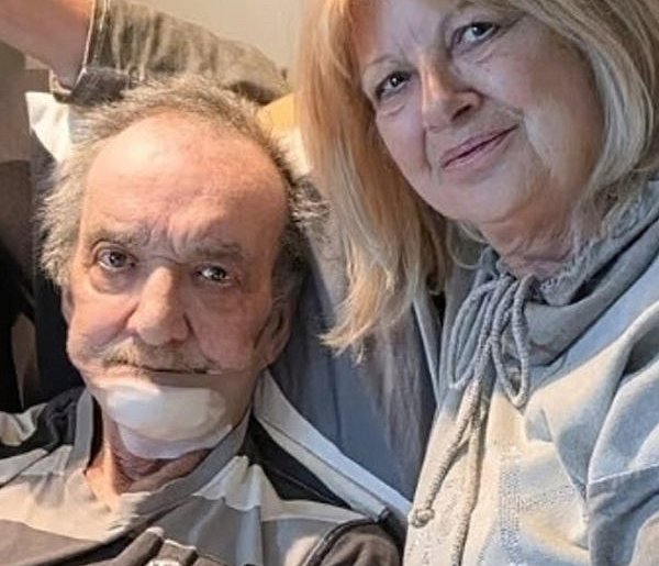 Pan Wojciech marzy o brakującej części twarzy. Operacja jest bardzo kosztowna-80694